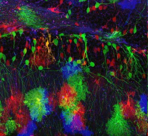 Brainbow Asztrocita transgenic multicolor labeling