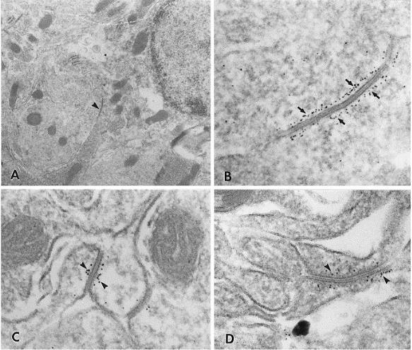 Asztrocita Nagy JI 1998 Connexin43 asztrocita rés-kapcsolatokban immunogold jelöléssel.