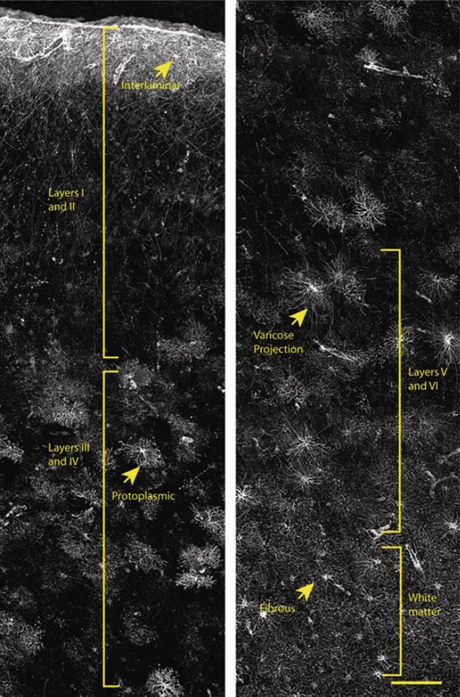 4 fő GFAP + sejtcsoport a humán agykéregben 1. 1. réteg: interlamináris asztrociták sejttestjei, melyek nyúlványai a 2-4. rétegbe nyúlnak pár mm mélyen; tekervényes (tortuous) morfológia 2.