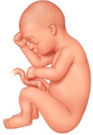 A szülésvezetés módja harántfekvés esetén Harántfekvés esetén, mivel abszolút szülési akadályt jelent, császármetszést kell