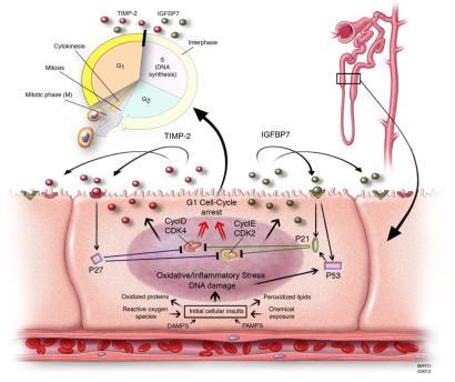 CELL CYCLE ARREST BIOMARKER: SAPPHIRE study G1 CELL CYCLE ARREST BIOMARKEREK Cél: új AKI (vizelet)biomarkerek felfedezése/azonosítása (Discovery study) és validálása Két multicentrikus tanulmány Két