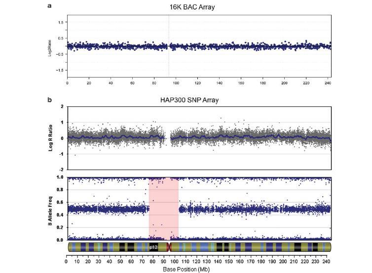 A SNP array-k ereje: loss-of-heterozygosity detektálása, kópiaszám