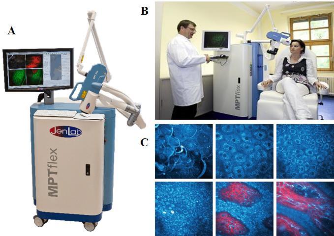 11. ábra A,B: Multifoton mikroszkópiás elven működő klinikai készülék a DermaInspect felépítése és használata. C: A bőr in vivo keresztmetszete DermaInspect berendezéssel.