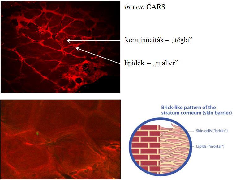 17. ábra Kontroll in vivo bőrmintáról készített CARS mikroszkópiás képek.