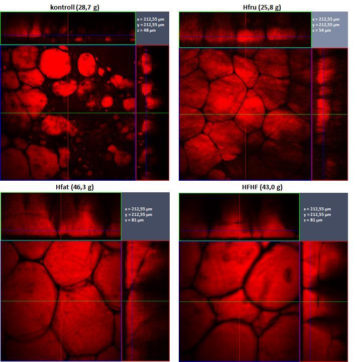 4.3.3 A szubkután zsírsejtek vizsgálata Az ex vivo CARS felvételek alapján a különböző egércsoportokra jellemző zsírsejtek méretbeli különbségei egyértelműen meghatározhatók. A 27.