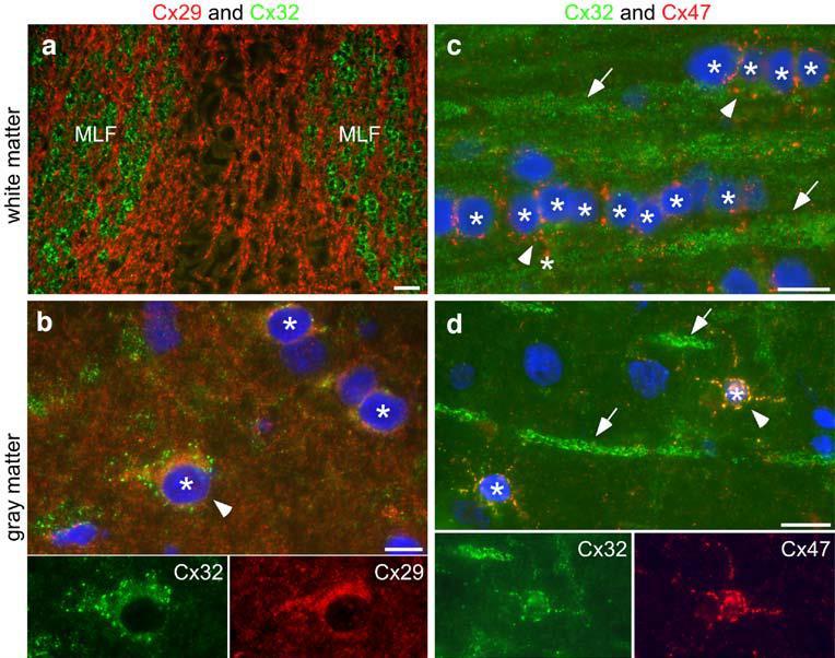 Oligodendrociták Rés-kapcsolatok a: In transverse sections of the pons, the large myelinated fibers of the medial longitudinal fasciculus (MLF) are Cx32-positive, whereas the surrounding smaller