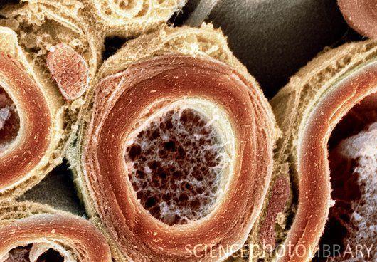 Schwann sejt, PNS axon - myelinálás a periférián - egy Schwann sejt