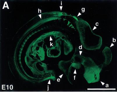 Oligodendrociták (ODC) RIP antigén CNPase - patkány oligodendrogliával immunizáltak (1960as évek.