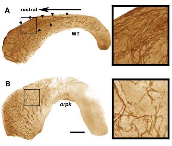 Neuroblast migration parallels cerebrospinal fluid (CSF) flow Vad típus PSA-NCAM festés Tg737orpk mutáns egér: hibás csillóképződés (hypomorphic allele for Polaris, which is essential for normal