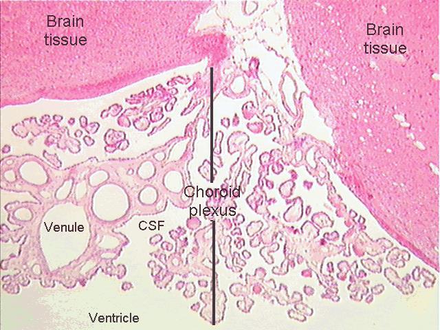 Ependima choroid plexus