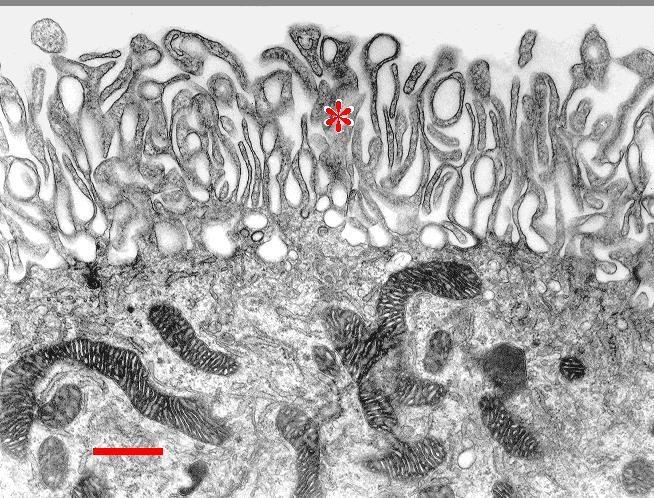 Ependima choroid plexus The free cellular surface of the choroid plexus.