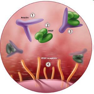 erek képződésének gátlása: VEGF mennyiségének csökkentése a receptorhoz kötődés