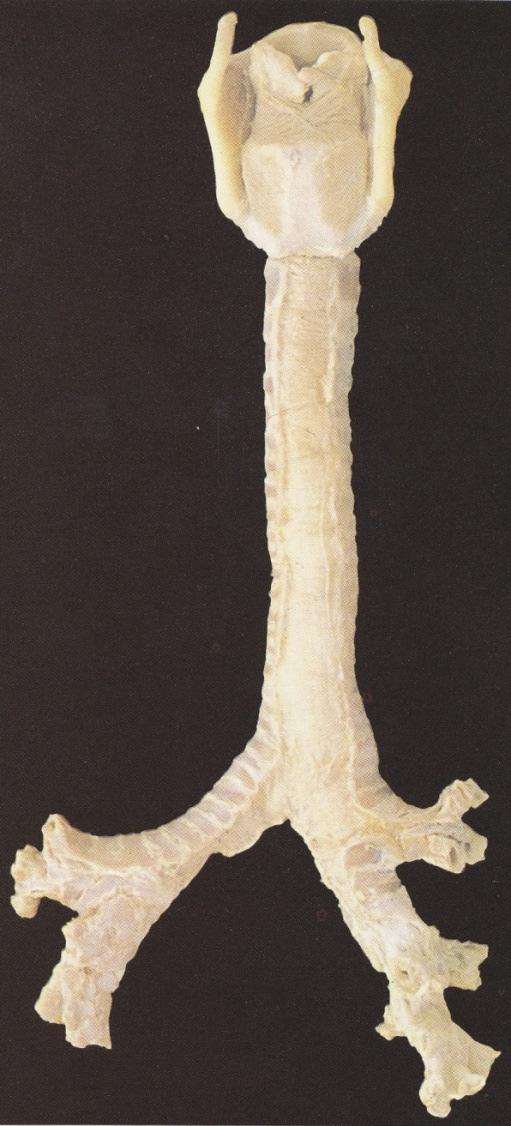 Cartilago cricoidea Cartilagines tracheales (15-20) Paries cartilagineus 1 2 Bifurcatio tracheae aspectus anterior Cartilago thyroidea Ligamentum cricotracheale Ligamenta anularia 1.