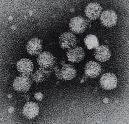 Hepatitis