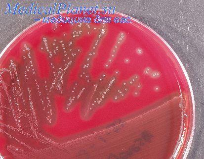 5. Streptococcus pyogenes véres agaron
