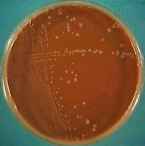 8. Haemophilus