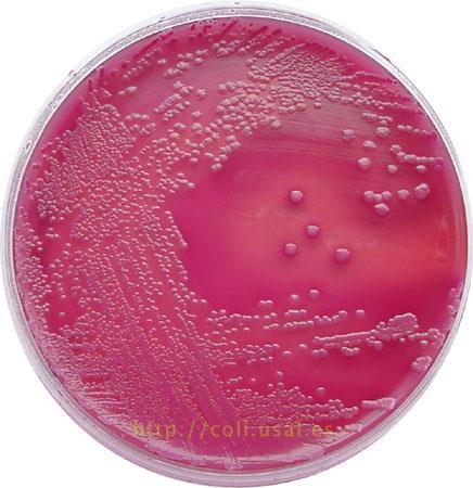 agar