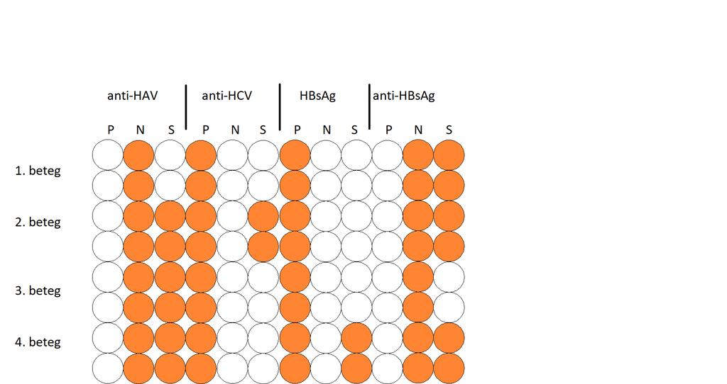 Hepatitis ELISA anti-hav: kompetitív ELISA, 1. beteg pozitív (átesett a fertőzésen vagy oltott) anti-hcv: 2.