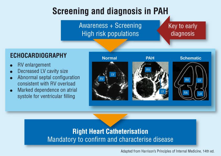 PAH SCREENING - DIAGNOSIS Magas rizikójú csoportok rendszeres szűrővizsgálata ECHOCARDIOGRAPHIA Tág jobb