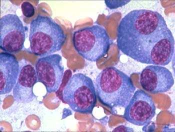 Plasma cells