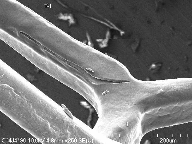 location of the Cutting Balloon blades IVUS