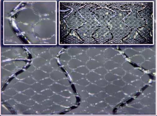 MGuard stent -embolia védelem Mikrostrut a struton belül Öntáguló