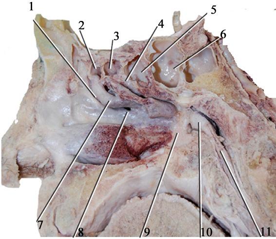 maxillaris benyílása (8) os palatinum, lamina perpendicularis(9), torus