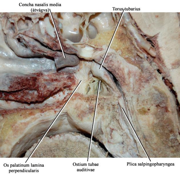tympaniból ide nyílik a fülkürt (Ostium pharyngeum tubae auditivae) Ostiumot A alakban plica salpingopharyngea veszi körbe (azonos nevő garatemelı izom