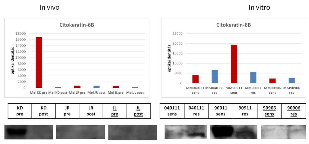 Az in vitro sejtvonalpárok közül az MM90911 sejtvonalpár rezisztens tagjában megnőtt a doublecortin fehérje expressziója a szenzitív sejtpopulációkhoz képest, míg az MM040111 és MM90906 sejtvonalban
