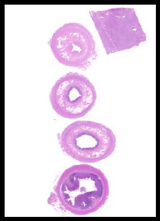 Dekalcinálás: A Laborok: 57%-a EDTA 14%-a Gooding és Stewarts 29%-a egyéb módszer: RDO (Rapid Decalcifier) SUSA 10% salétromsav Stieve oldat Zenker/jégecet