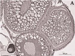 NEGATÍV HYPOTHALAMUS FEEDBACK GnRH