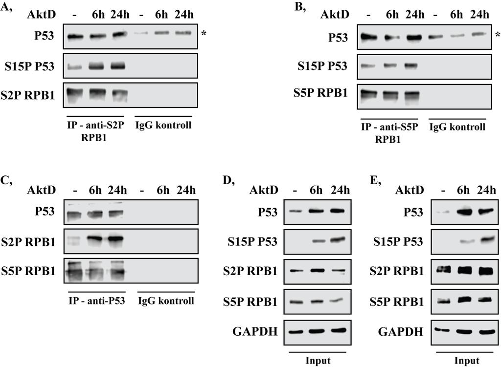 24. ábra A P53 kölcsönhat az S2P RPB1 és az S5P RPB1 fehérjékkel A, P53 illetve S15P P53 és S2P RPB1, B, P53 illetve S15P P53 és S5P RPB1 közti kölcsönhatás vizsgálata ko-immunprecipitációval