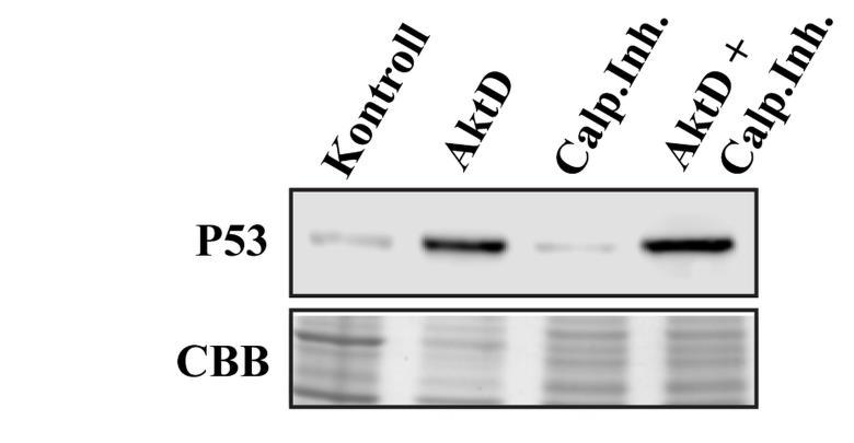 ábra A P53 AktD és MG132 kezelést követő degradációra nem kalpain által szabályozott útvonalon keresztül valósul meg A, A P53 és az RPB1 fehérje