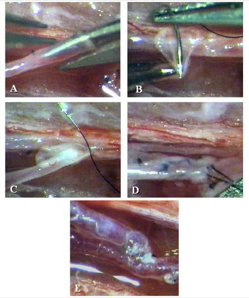 75. ábra Patkányban a v. saphena medialis és az a. saphena között mikrosebészeti módszerekkel létrehozott end-to-side arterio-venosus shunt készítésének főbb lépései: a v.