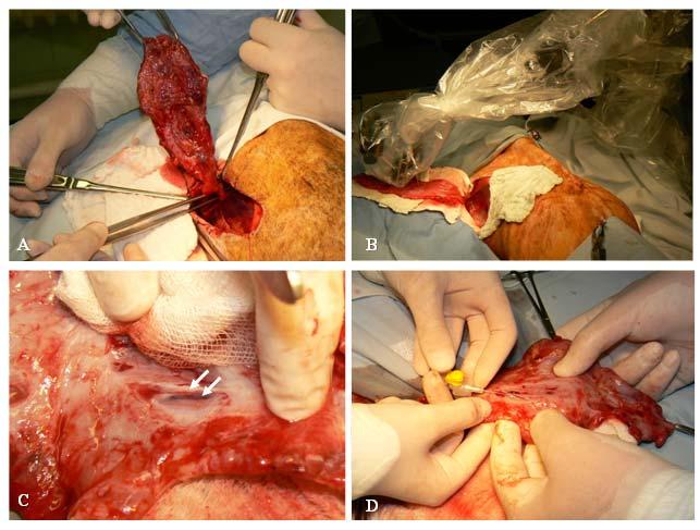 postoperative napon végzett reoperáció során készített képek a latissimus dorsi izomlebeny preparálásáról (A), mikrokeringési vizsgálatairól (B), a