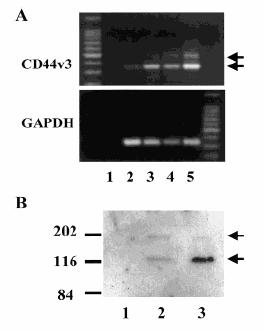 475 346 180 kda 120 kda 11. ábra. A CD44v3 expresszió detektálása MOLT-4 és CCRF-CEM sejtekben RT-PCR (A) és Western blot (B) által.