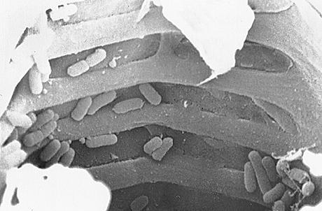 Xanthomonas oryzae pv.