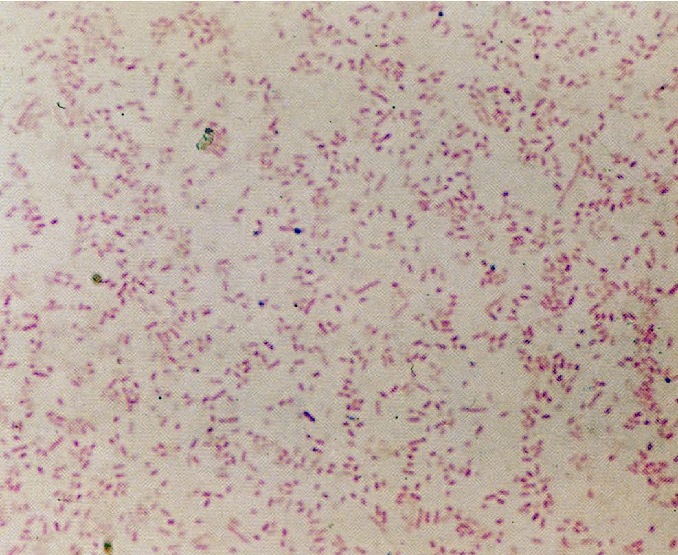 Haemophilus influenzae Pfeiffer izolálta az 1980-as