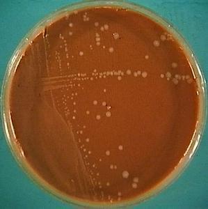 Tenyésztés Csokoládé agar - X faktor: haemin V faktor: NAD Inkubáció - 37 C, aerob, 24 hrs Telepek - kicsi -