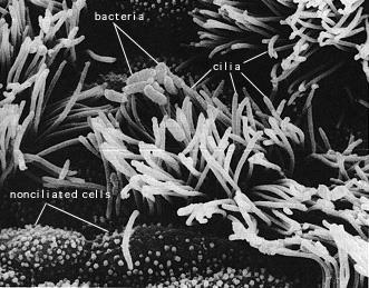 Szinergizmus a pertussis toxin és a filamentosus hemagglutinin között a ciliáris légúti epitheliális