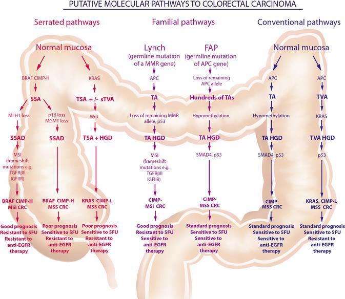 The serrated pathway to colorectal carcinoma: current concepts and challenges Histopathology Volume 62, Issue 3, pages