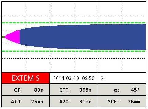 8E vvt, NA, 100 mmol HCO 3,