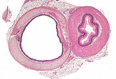 Légcső: Mucosa