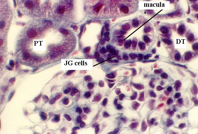 JGA részei: macula densa: a disztális tubulus megvastagodott része, keskeny, magas, csillós sejtek alkotják Na- osmoreceptor, érzékeli a Na koncentrációt és továbbítja a juxtaglomeruláris sejtekre: