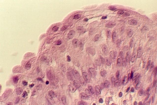 Húgyhólyag (Vesica urinaria): Többmagsoros hám (urothelium) béleli, alatta kötőszövet