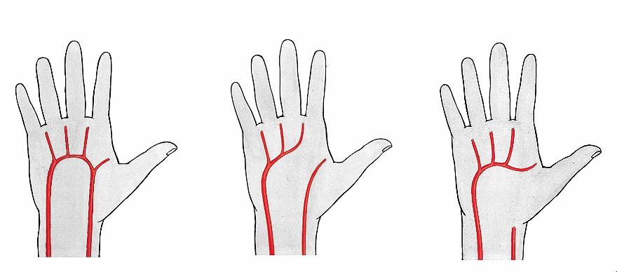 Aponeurosis palmaris ujjhajlító inak között A.