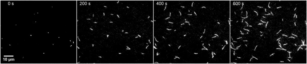 fluoreszcens jelölővel ellátott egyedi aktin filamentumok megfigyelését. Reprezentatív mikroszkópos felvételeken látható (25.