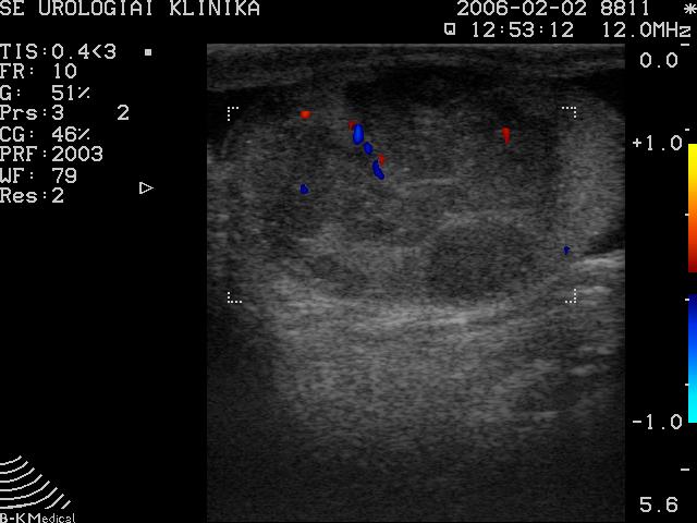 Spermatocytas Embryonális