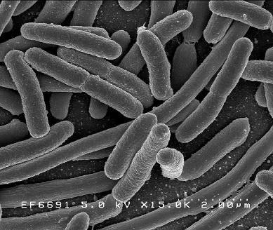baktériumok Az eukarióták olyan élőlények, amelyek valódi sejtmaggal