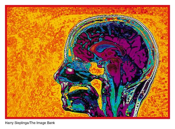 Magnetic Resonance Imaging (MRI) a gyógyászatban előnyök: - nem használ ionizáló sugárzást mint a röntgen - nem kell festék vagy kontrasztanyagot bevinni - lágy-szövetek kontrasztosabbak kivitelezés: